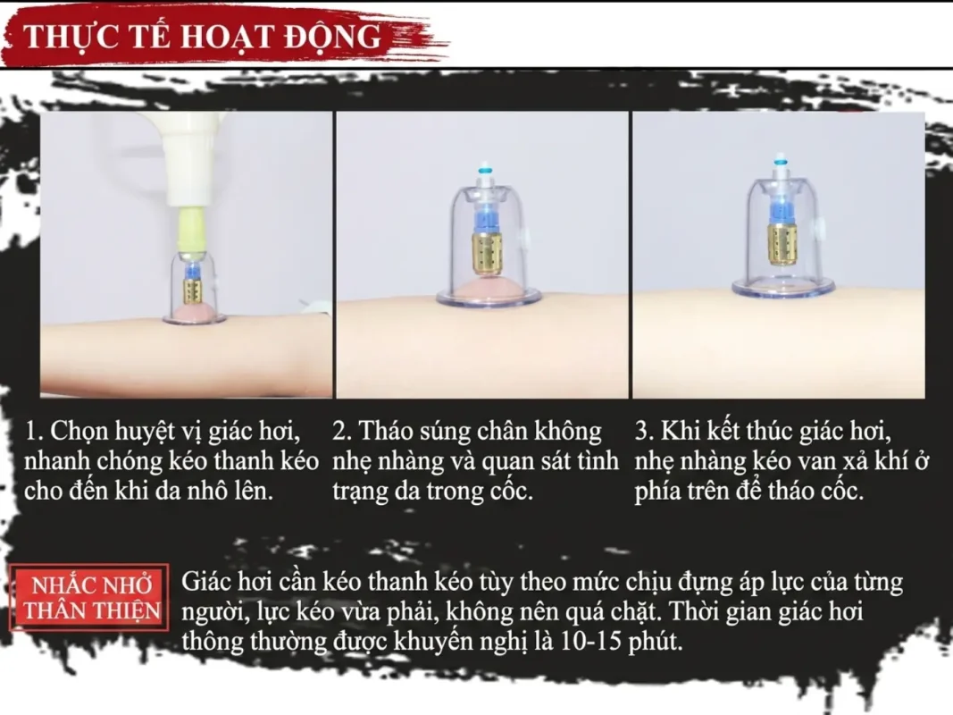 Bộ Giác Hơi 27 Cốc Lượng Từ Cao Cấp